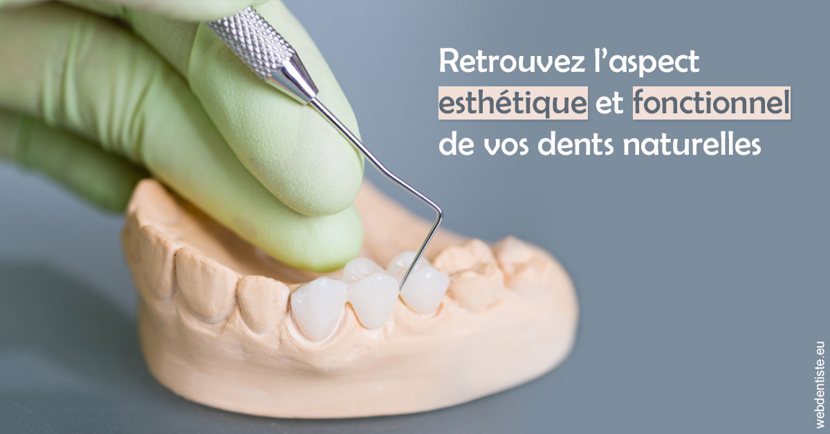 https://dr-gonnet-laurent.chirurgiens-dentistes.fr/Restaurations dentaires 1
