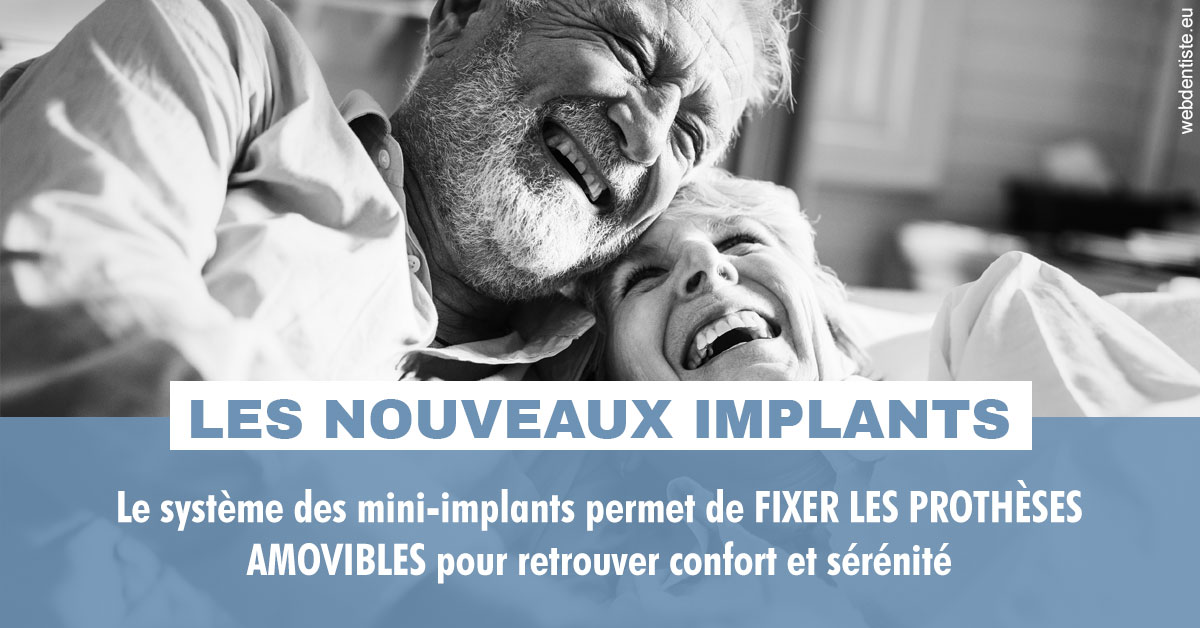 https://dr-gonnet-laurent.chirurgiens-dentistes.fr/Les nouveaux implants 2