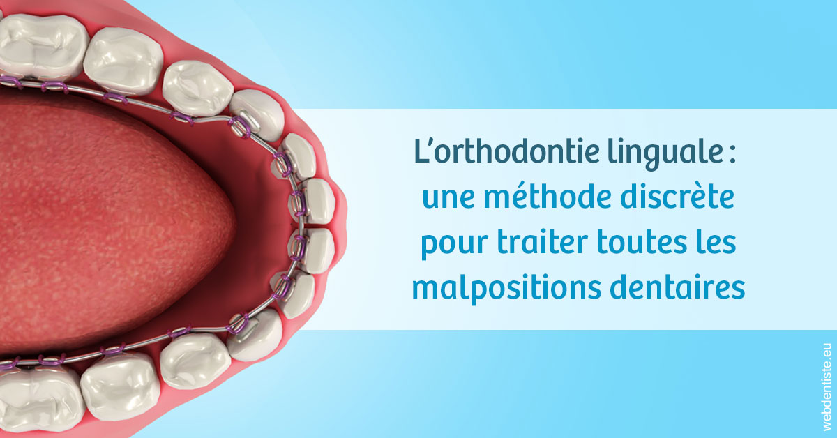 https://dr-gonnet-laurent.chirurgiens-dentistes.fr/L'orthodontie linguale 1