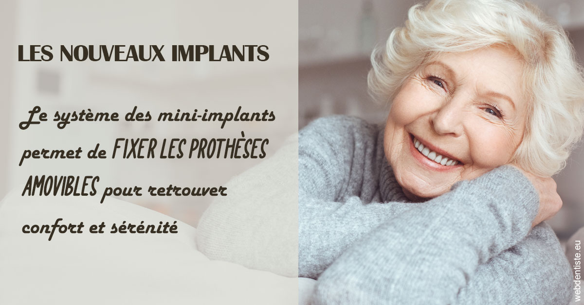 https://dr-gonnet-laurent.chirurgiens-dentistes.fr/Les nouveaux implants 1