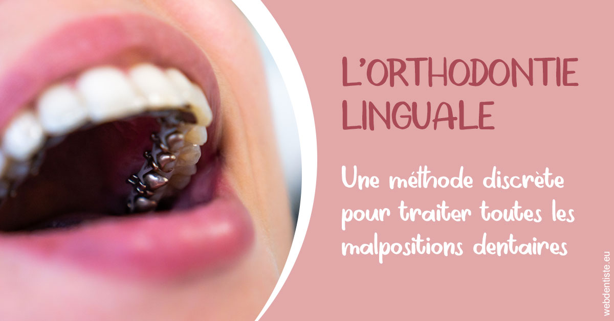 https://dr-gonnet-laurent.chirurgiens-dentistes.fr/L'orthodontie linguale 2