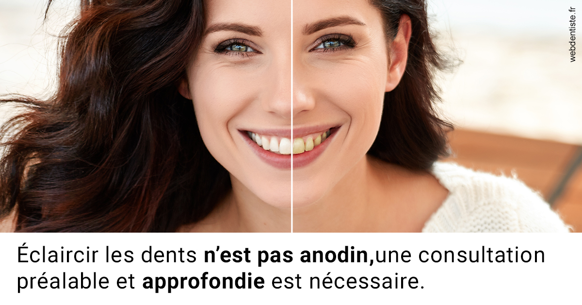 https://dr-gonnet-laurent.chirurgiens-dentistes.fr/Le blanchiment 2