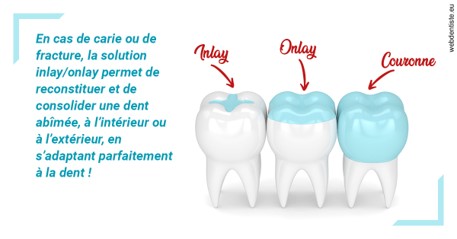 https://dr-gonnet-laurent.chirurgiens-dentistes.fr/L'INLAY ou l'ONLAY