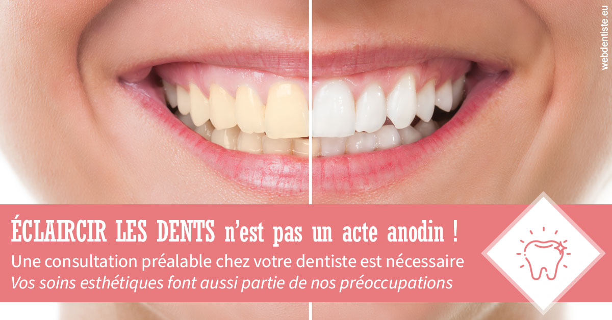 https://dr-gonnet-laurent.chirurgiens-dentistes.fr/Eclaircir les dents 1