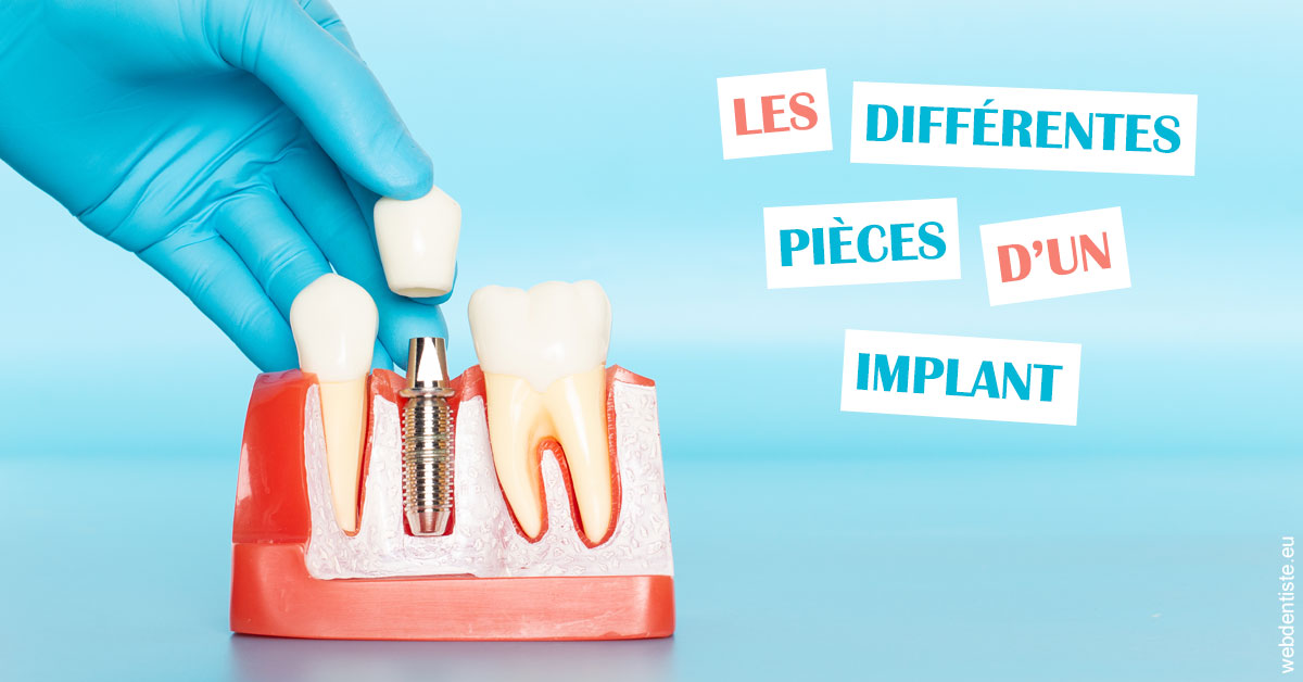 https://dr-gonnet-laurent.chirurgiens-dentistes.fr/Les différentes pièces d’un implant 2