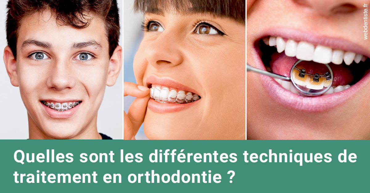 https://dr-gonnet-laurent.chirurgiens-dentistes.fr/Les différentes techniques de traitement 2