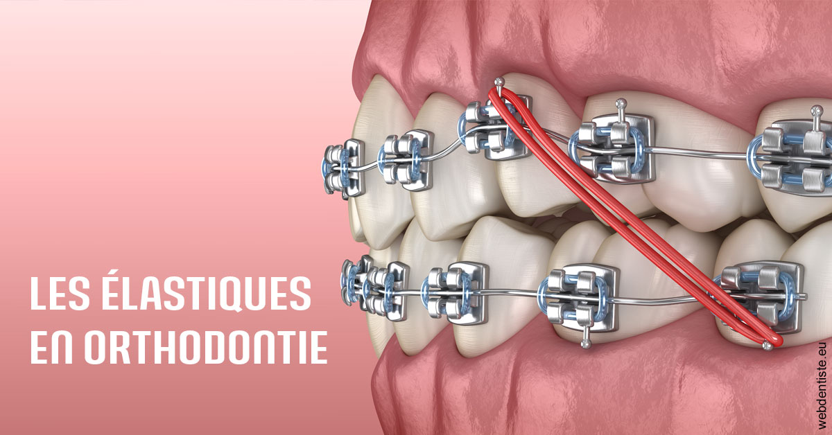https://dr-gonnet-laurent.chirurgiens-dentistes.fr/Elastiques orthodontie 2