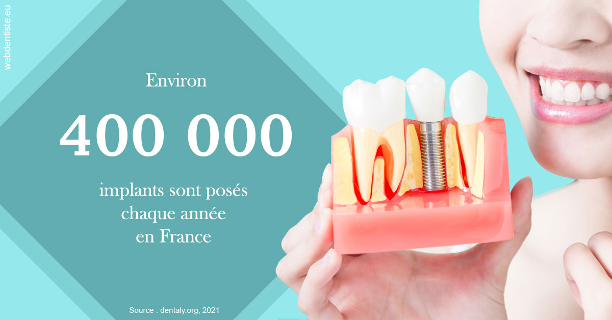 https://dr-gonnet-laurent.chirurgiens-dentistes.fr/Pose d'implants en France 2